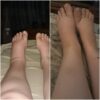 20-30 mmHg Women Knee High Closed Toe Compression Socks